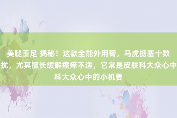 美腿玉足 揭秘!这款全能外用膏,马虎搪塞十数种肌肤困扰,尤其擅长缓解瘙痒不适,它常是皮肤科大众心中的小机要